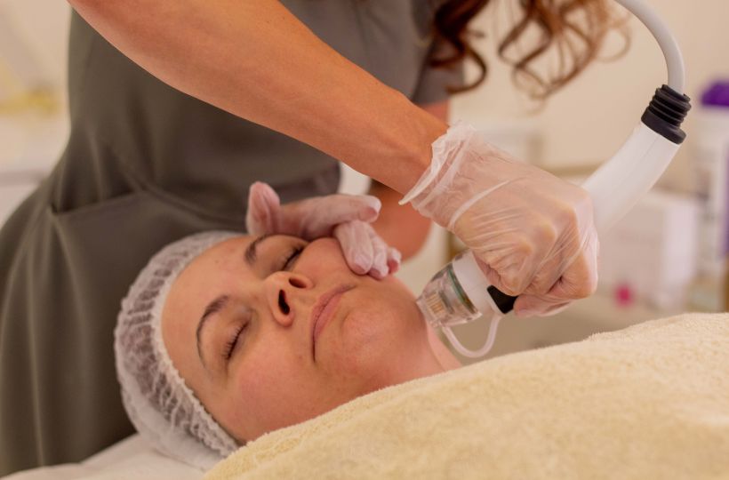 RF Microneedling
