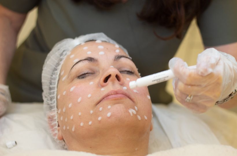 Bio Meso Liquid Microneedling