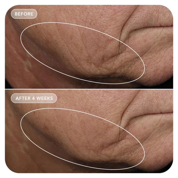 IMAGE Skincare VOL.U.LIFT™ 4D Skin Rebound Complex - Image 3